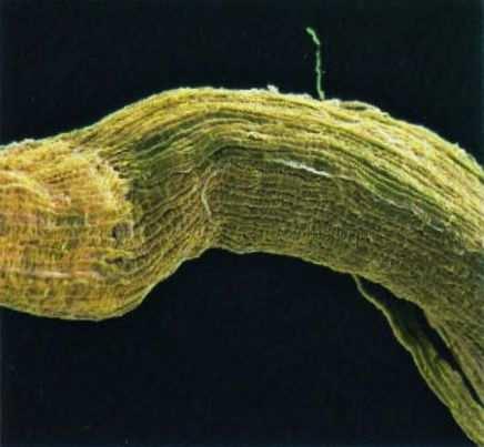 Im Einschaltbild wird der lamellenartige Aufbau dieser Scheide deutlich. Im rechten Bildteil langsam leitende Nervenfasern (NF) von einer Schwannschen Zelle umgeben.
