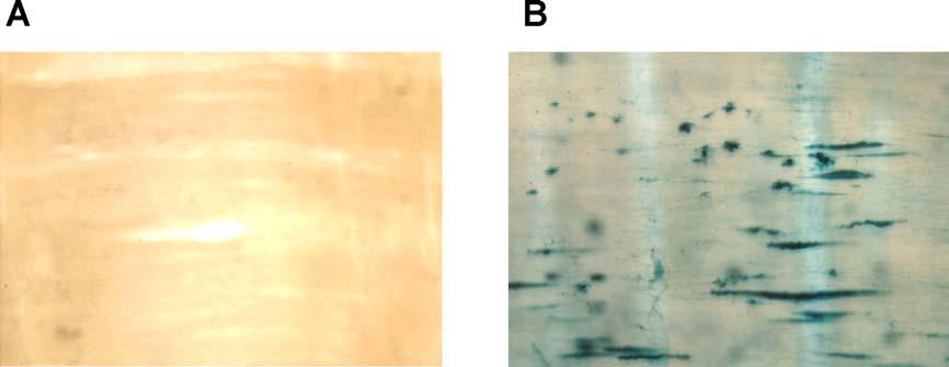 IV Ergebnisse Longitudinalmuskulatur des Meerschweinchenileums Auch die untersuchte Darmmuskulatur des Meerschweinchens zeigt nach der Infektion und der Inkubation mit X-gal-Färbelösung eine nicht