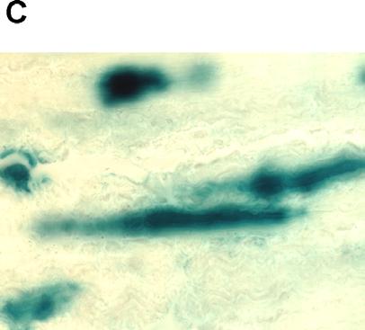 Mikroskopische Aufnahmen zeigen, daß in der Mitte der Gewebepräparate Zellen unterschiedlicher Form infiziert werden (Abb. IV-15; B). Abb.