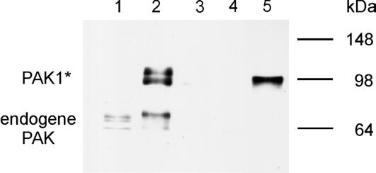 IV Ergebnisse Folgende Faserpräparate werden anaylsiert: a) mit Triton X-100 permeabilisierte Taenia caeci direkt nach Abschluß des Häutungsvorganges (Abb.