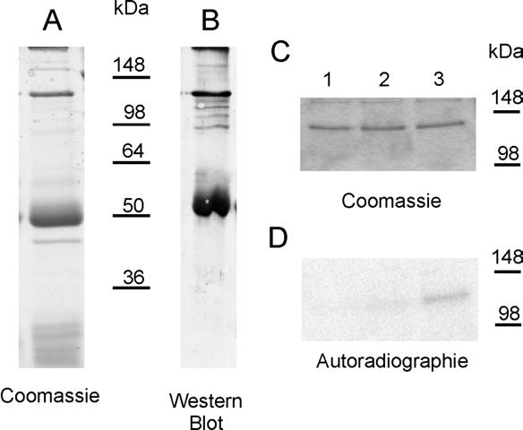 IV Ergebnisse Antikörpers eindeutig als Caldesmon identifiziert werden. Außerdem werden im Western Blot auch einige Degradationsprodukten des Caldesmons vom Antikörper erkannt.