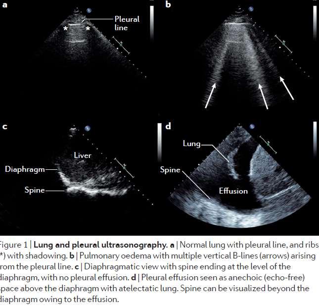 Lung US & Pleura US Price S, et