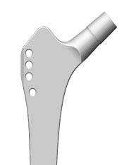 Abb. 4-1: Proximaler Bereich der Abb. 4-2: Detail Halsbereich des 12/14 Alloclassic Hüftprothese mit Konus. Links: Standard-Hals und Rechts: 12/14 Konus.
