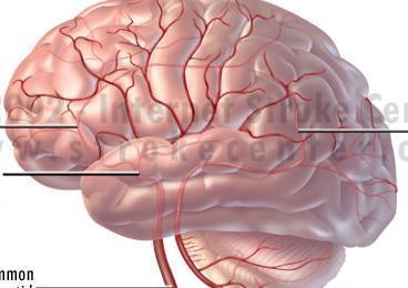 Neuroanatomie: Multiple Sklerose 10