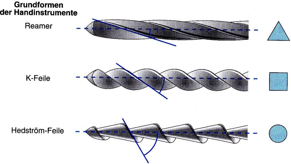 Formgebung des Wurzelkanals zur Ermöglichung des Auffüllens des Wurzelkanalsystems (Hellwig 2009:383) 2.