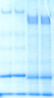 IKKe LacZ IRS1 + IKKe IRS1 IR K/A + IKKe IR K/A Abbildung 14: Coomassie-gefärbtes SDS-Gel des IRS1-Kinase-Assays HEK293rapid-Zellen wurden mit der kinase-inaktiven Form des Insulinrezeptors (IR K/A)