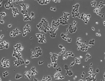 Ergebnisse 100 µm 100 µm Abbildung 27: mit GFP-markierter sirna transfizierte FAO-Zellen Als Transfektionskontrolle wurden FAO-Zellen mit GFP-markierter sirna