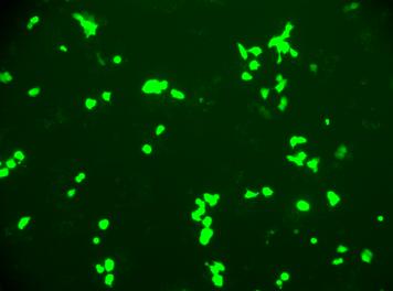 Links zu sehen sind die FAO-Zellen im Durchlicht. Die rechte Abbildung zeigt die Zellen nach 48 h unter dem Fluoreszenzmikroskop.