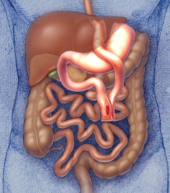 Hindgut Theorie schnelle Nahrungspassage nicht vollständige enzymatische Aufspaltung endogene Hochregulation von GLP-1