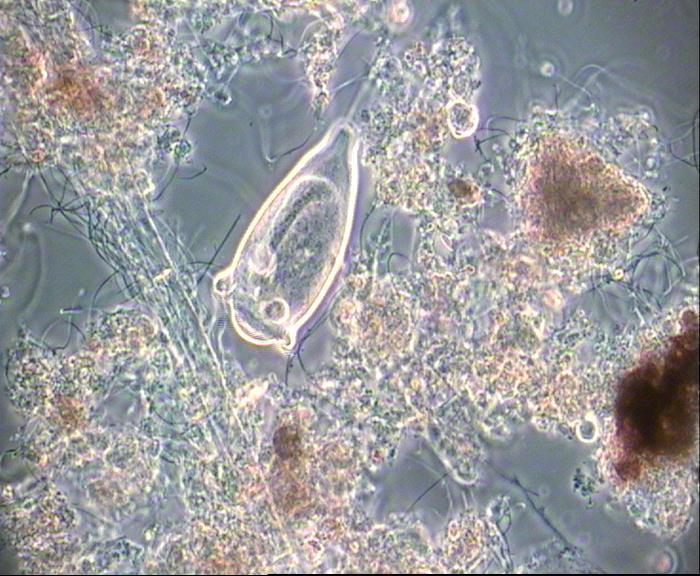 Dunkelfeld (DF)-Mikroskopie