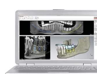 Die digitale Volumentomografie kurz DVT ist ein hochmodernes Diagnoseverfahren.