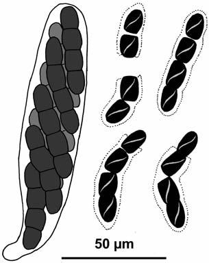 V. BRACKEL, W.: Flechtenbewohnende Pilze in Bayern IV 37 9 50 µm Abb. 9: Sporormiella peltigerae, Holotypus: Ascus mit Ascosporen, reife Ascosporen in verschiedenen Zerfallsstadien. Abb. 10: Sporormiella peltigerae, Holotypus; Schnitt durch ein Perithecium mit Asci sowie Sporen in- und außerhalb der Asci.