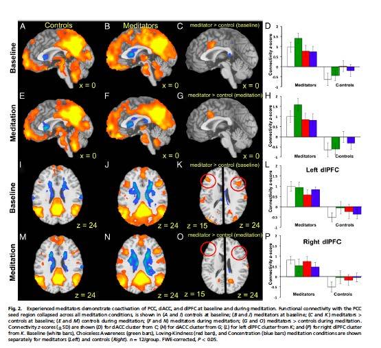 Achtsamkeitsmeditation und das Default Mode Network (DFN)" - DFN -> Wandernde Gedanken, selbstbezogen, bedrückte Stimmung" - Weniger DFN bei erfahrenen Meditierenden in der Meditation, mehr kognitive