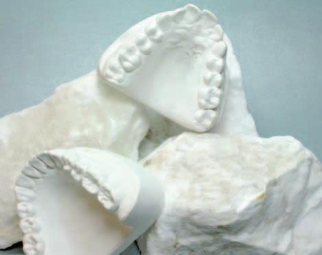 Modellgips, Typ 2 Universal Dental-Alabastergips Hergestellt aus dem reinen Alabaster des Harzgebirges, mit 25 % Hartgipszusatz.