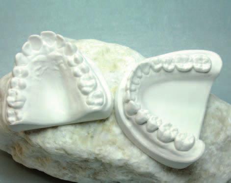 Spezial Dental-Alabastergips Hergestellt aus dem reinen Alabaster des Harzgebirges, mit 25 % Hartgipszusatz. Ein Material mit kontrollierter Expansion, ergibt volumenbeständige, harte Modelle.