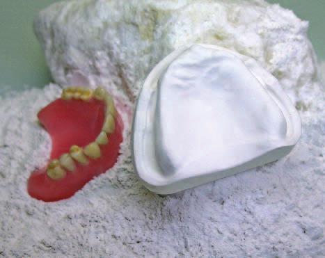 Modellhartgips, Typ 3 Neo Marmorit E Neo Marmorit E ist ein speziell formulierter Dentalgips mit hoher Abbindeexpansion.
