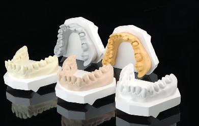 Gips Typ 4 Modell- und Zahnkranzgipse SHERAMAXIMUM 2000 Superhartgips für besonders hohe Ansprüche - außergewöhnlich fließfähig bei guter Thixotropie - scanbar mit diversen Systemen - ideal für
