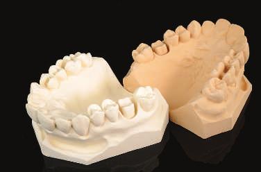 Gips Typ 4 / 5 Modell- und Zahnkranzgipse SHERAFAVORIT Kunststoffvergüteter Superhartgips - für harte Abdruckmaterialien - leicht zu entformen - ideal um dünne und unter sich gehende Stümpfe