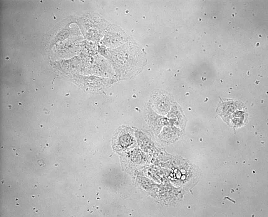 293-Zellen (Human Embryonic Kidney Fibroblasts 293 T cells = HEK 293) Diese Zellen exprimieren die meisten Toll-like-Rezeptoren nicht und reagieren daher nicht auf Toll-like-Rezeptor-Agonisten.