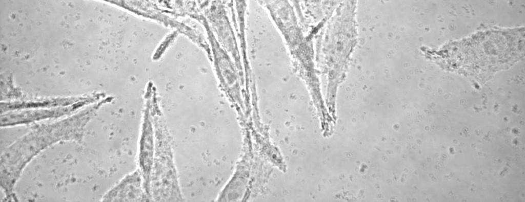 al, 1991), low aggressive cell line (Kunz et al, 1999). Abbildung 010. IF6-Zellen, 40fache Vergrößerung.