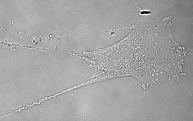 PKR +/+ Mouse/Murine Embryonic Fibroblasts Immortalisierte Embryonic Fibroblasts von PKR +/+ - Mäusen wurden für Experimente dieser Arbeit verwendet.
