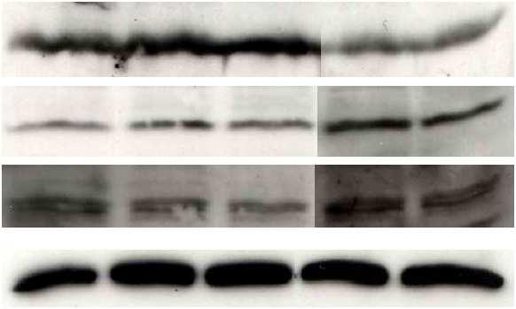 4.02.4. Mel526 Induktion von BH3-only-Proteinen Mit Imiquimod und Loxoribin behandelte Mel526-Melanomzellen zeigen keine vermehrte Expression von BH3-Proteinen: Noxa, Puma und Hrk sind schon in