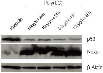 vergleichen. Bestätigt wird hier eine klare Induktion von Noxa durch Poly(I:C). P53 zeigt sich in unbehandelten Zellen hoch exprimiert. Die Expression nimmt nach Poly(I:C)-Behandlung ab.