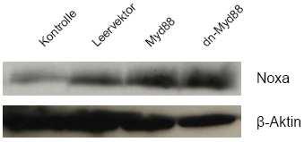 4.03.3.3. Der Toll-like-Rezeptor-Adapter MyD88 Um zu prüfen, ob eine Noxa-Induktion in HaCaT-Zellen MyD88-Abhängigkeit zeigt, werden MyD88 +/+ - sowie MyD88-dn-Vektoren transient in HaCaT-Zellen