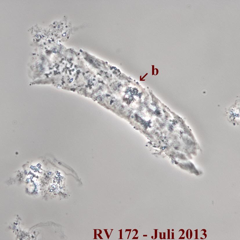 Phase Contrast Urinkontrollen I Sediment