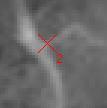 Objektpixelgröße Satellit Aufnahme Sonnenhöhe Inzidenzwinkel ausgeliefert Original Pleiades 1A 24.4.2013 59.2 5.8 50 cm 70 cm mittleres Bild WorldView-1 16.9.2008 49.7 28.6 50 cm 56 cm QuickBird 23.5.2004 64.