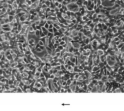 Abb. 18: Endothelzellen aus dem Corpus luteum in Rückbildung, 17 Wochen in Kultur. In vitro-angiogenese.