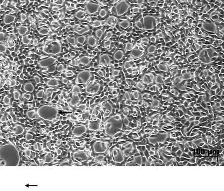 105 Abb. 19: Endothelzellen aus dem Corpus luteum in Blüte, 13 Wochen in Kultur. In vitro-angiogenese.