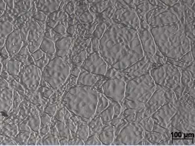 28: Endothelzellen aus dem Corpus luteum in Rückbildung, 10 Wochen in Kultur. In vitro-angiogenese.