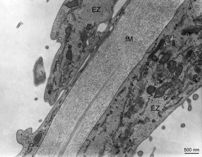 138 Abb. 60: Endothelzellen aus dem Corpus luteum in Rückbildung.