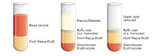 Auftrennung der Blutzellen: Gradientenzentrifugation FicollPaque buffy coat: entält PBMCs (peripheral blood mononuclear cells) = mononukleäre Zellen des