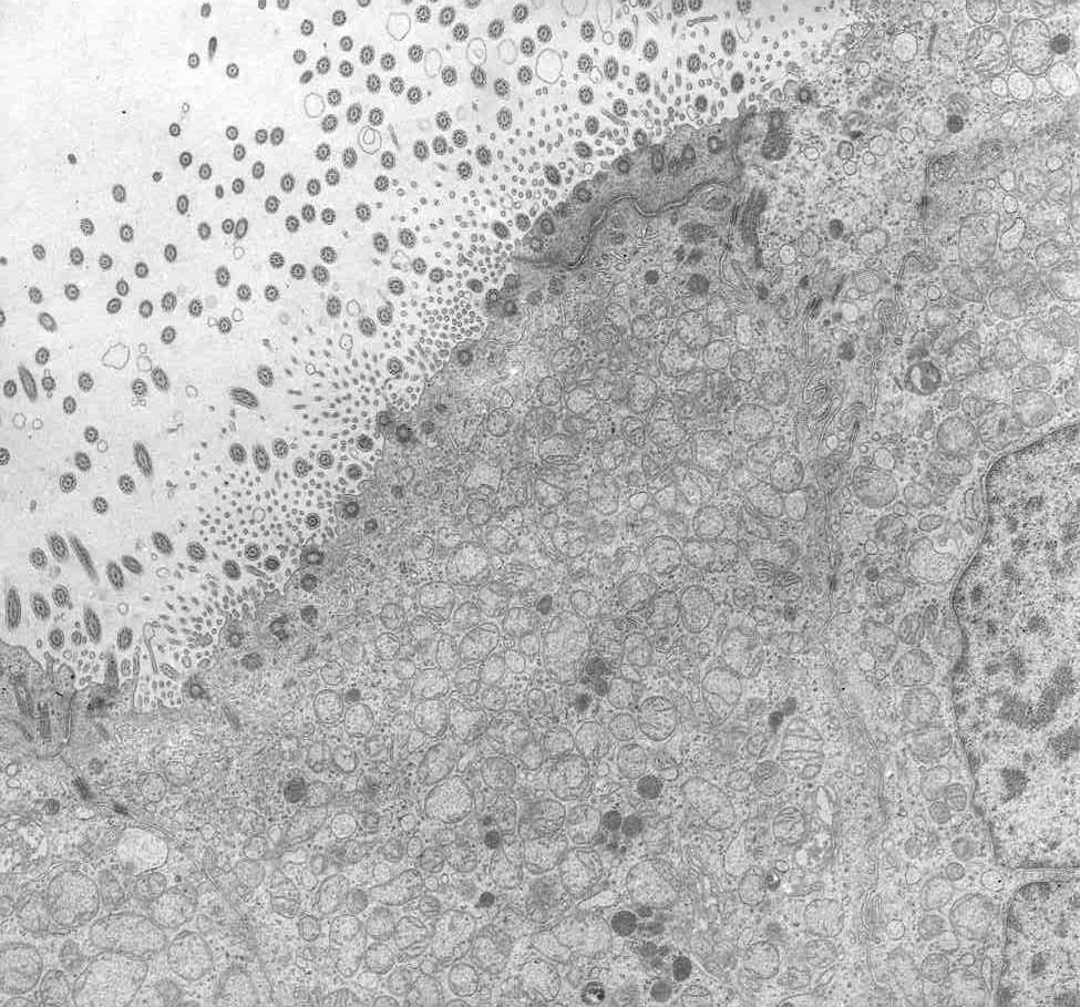 entwickelt. Er liegt neben dem Zellkern. Lysosomen sind nur in einigen Zellen zu finden. In diesem Fall liegen mehrere Granula an einer Stelle.