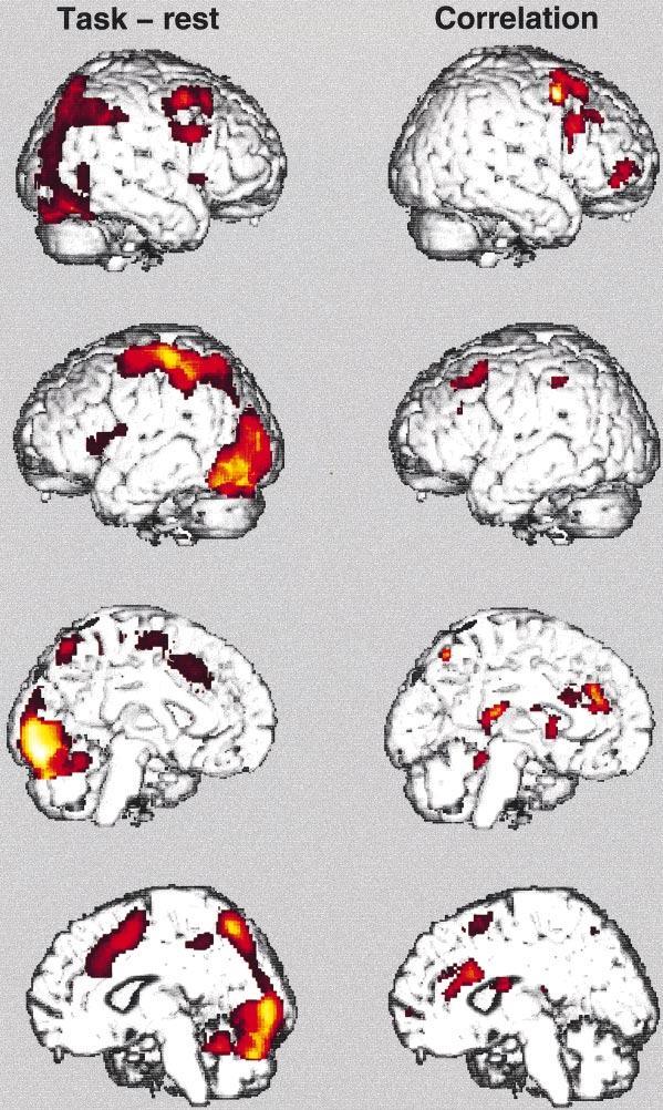 Ergebnisse: Funktionelle Bildgebung Differenz der Aktivierung TOL - Baseline Korrelation zwischen der Aktivität in verschiedenen Hirnregionen und der Planungskomplexität Posteriorer