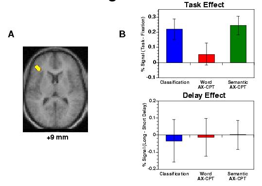 Ergebnisse (1) Region im linken ventrolateralen präfrontalen Kortex (VL-PFC) erhöhte Aktivierung in der semantischen