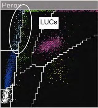 Große peroxidasenegative Zellen LUC Bei der Auswertung der Perox-Scattergramme des ADVIA 120 zeigte nach Induktion der Aggregation mit Kollagen überraschenderweise eine Zunahme