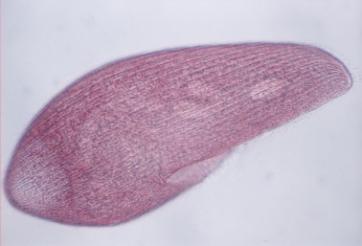 Während kalter Jahreszeiten oder in Trockenperioden zieht sich P. antipodarum in tiefere Sedimentschichten zurück. Unter Laborbedingungen wurde P. antipodarum in Zehn-Liter-Glasaquarien gehalten.