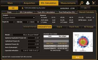 Präzise torische IOL Berechnung In der ALADDIN Software ist ein stabiler und spezifischer IOL Rechner integriert.