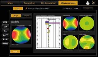 Aberrometrie-Analyse (Zernike) Die Zernike-Analyse der topographischen Daten ermittelt die Differenz in der optischen Achse (OPD) sowie Informationen zu