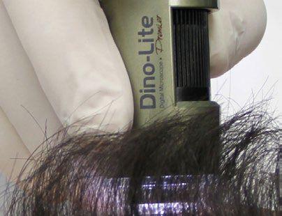 Trichoskopie ist eine relativ junge Wissenschaft, welche die Gesundheit der Haare und der Kopfhaut studiert.