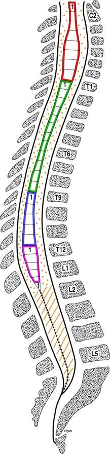 Spinalkanal Spinalkanal Summe der Foramina vertebralia (Wirbelbogen, Wirbelkörper), dazwischen: Disci intervertebrales, Facettengelenke, Bandapparat Foramina intervertebralia: seitlicher Austritt