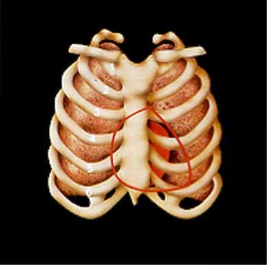 Anatomische Lage des Herzens Schallauslöschung durch: knöcherner