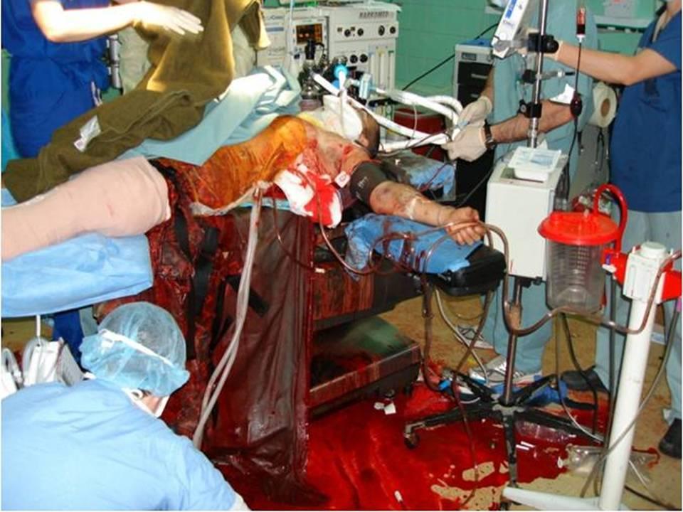 9. Transfusionen 9.3 Notfalltransfusionen (1/2) In Notfällen.