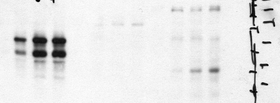 3 Ergebnisse Proteasom System abgebaut. Um zu untersuchen, ob GrB in Hefezellen akkumuliert, wurden Western blot Analysen mit Lysaten der Hefezellen durchgeführt (Abb. 3 27).