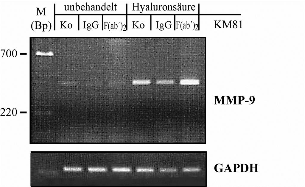 Abb. 18: Blockierung der Hyaluronsäure-Bindungsfähigkeit von CD44 unterdrückt nicht die Hyaluronsäure-vermittelte Expression von MMP-9 Jeweils 2 x 10 6 3LL-Zellen wurden mit 100 µg KM81 (IgG) bzw.