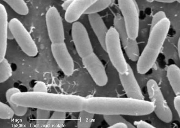 Die Bakterien "Lactobacillus acidophilus" leben in unserem Darm und übernehmen wichtige Funktionen bei der Verdauung. Hier handelt es sich um einen für den Menschen wichtigen Mikroorganismus.
