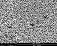 Amino-Trisopor 1500, Referenzbalken 1 µm.